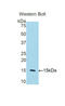 CD59 Molecule (CD59 Blood Group) antibody, LS-C301168, Lifespan Biosciences, Western Blot image 