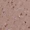 ST6 N-Acetylgalactosaminide Alpha-2,6-Sialyltransferase 5 antibody, HPA070354, Atlas Antibodies, Immunohistochemistry frozen image 