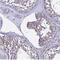 Immunoglobulin Superfamily Member 11 antibody, NBP1-92021, Novus Biologicals, Immunohistochemistry paraffin image 