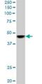 SWI/SNF Related, Matrix Associated, Actin Dependent Regulator Of Chromatin, Subfamily B, Member 1 antibody, H00006598-M01, Novus Biologicals, Western Blot image 