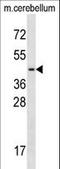 Transcription Factor 7 Like 2 antibody, LS-C161773, Lifespan Biosciences, Western Blot image 