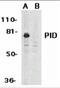 Metastasis Associated 1 Family Member 2 antibody, 2443, ProSci, Western Blot image 