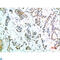 Fc Fragment Of IgG Receptor Ia antibody, LS-C813813, Lifespan Biosciences, Immunohistochemistry paraffin image 