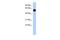 Membrane Palmitoylated Protein 7 antibody, GTX45577, GeneTex, Western Blot image 