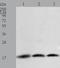 Baculoviral IAP Repeat Containing 5 antibody, TA323465, Origene, Western Blot image 