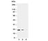 TNF Superfamily Member 10 antibody, R30489, NSJ Bioreagents, Western Blot image 