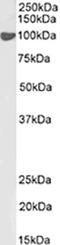 Nuclear Receptor Subfamily 3 Group C Member 1 antibody, CL7660AP, Cedarlane Labs, Western Blot image 