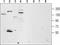 Transient Receptor Potential Cation Channel Subfamily M Member 4 antibody, TA328670, Origene, Western Blot image 