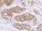 Peptidylprolyl Isomerase F antibody, 14689-T26, Sino Biological, Immunohistochemistry paraffin image 