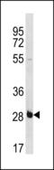 RNA-binding protein with multiple splicing antibody, LS-C203838, Lifespan Biosciences, Western Blot image 