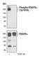 Platelet Derived Growth Factor Receptor Alpha antibody, PA5-17070, Invitrogen Antibodies, Western Blot image 