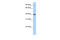 Arginase 2 antibody, 26-892, ProSci, Enzyme Linked Immunosorbent Assay image 