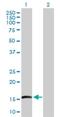 Epithelial Membrane Protein 3 antibody, H00002014-D01P, Novus Biologicals, Western Blot image 