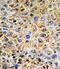 Decorin antibody, PA5-13538, Invitrogen Antibodies, Immunohistochemistry paraffin image 