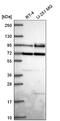 Dishevelled Segment Polarity Protein 2 antibody, NBP2-56345, Novus Biologicals, Western Blot image 
