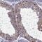 MAGE Family Member B1 antibody, PA5-51532, Invitrogen Antibodies, Immunohistochemistry paraffin image 