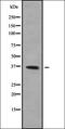 Olfactory Receptor Family 52 Subfamily E Member 6 antibody, orb336414, Biorbyt, Western Blot image 