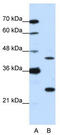 Ribosomal Oxygenase 2 antibody, TA345455, Origene, Western Blot image 