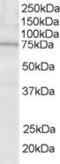 Lymphocyte Cytosolic Protein 2 antibody, LS-C20210, Lifespan Biosciences, Western Blot image 