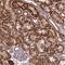 Transmembrane Protein 160 antibody, NBP2-30449, Novus Biologicals, Immunohistochemistry paraffin image 