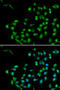 Catenin Beta Like 1 antibody, STJ28655, St John