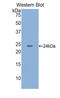 Cathelicidin Antimicrobial Peptide antibody, LS-C298403, Lifespan Biosciences, Western Blot image 
