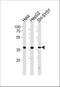 Translocase Of Inner Mitochondrial Membrane 50 antibody, A10056, Boster Biological Technology, Western Blot image 