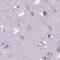 Outer Dense Fiber Of Sperm Tails 3 antibody, PA5-58709, Invitrogen Antibodies, Immunohistochemistry paraffin image 