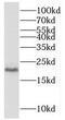 Malignant T cell-amplified sequence 1 antibody, FNab05070, FineTest, Western Blot image 