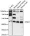 Sorting Nexin 4 antibody, LS-C750312, Lifespan Biosciences, Western Blot image 