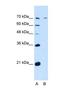 Polypeptide N-Acetylgalactosaminyltransferase 6 antibody, NBP1-69641, Novus Biologicals, Western Blot image 