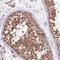 Adhesion Molecule With Ig Like Domain 1 antibody, NBP2-14287, Novus Biologicals, Immunohistochemistry paraffin image 