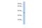 Carcinoembryonic Antigen Related Cell Adhesion Molecule 19 antibody, GTX46060, GeneTex, Western Blot image 