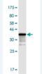 TGFB1-Induced Anti-Apoptotic Factor 1 antibody, H00009220-M04-100ug, Novus Biologicals, Western Blot image 