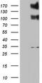 ALK Receptor Tyrosine Kinase antibody, TA801097, Origene, Western Blot image 