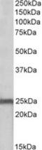 NADH:Ubiquinone Oxidoreductase Core Subunit S8 antibody, LS-C139604, Lifespan Biosciences, Western Blot image 