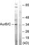 Aurora Kinase B antibody, PA5-38741, Invitrogen Antibodies, Western Blot image 