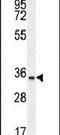 Chromosome 15 Open Reading Frame 41 antibody, PA5-24193, Invitrogen Antibodies, Western Blot image 