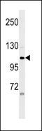 Zinc Finger Protein 33A antibody, LS-C157444, Lifespan Biosciences, Western Blot image 