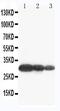 Aquaporin 6 antibody, PA5-78815, Invitrogen Antibodies, Western Blot image 