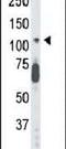 Cyclin-dependent kinase-like 5 antibody, PA5-14083, Invitrogen Antibodies, Western Blot image 