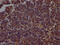 Poly(ADP-Ribose) Polymerase 1 antibody, CSB-PA017457LA01HU, Cusabio, Immunohistochemistry paraffin image 