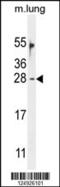 Ornithine Decarboxylase Antizyme 2 antibody, 55-401, ProSci, Western Blot image 