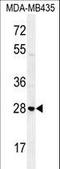 Syntaxin-19 antibody, LS-C161587, Lifespan Biosciences, Western Blot image 