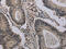 Histone Cluster 1 H2A Family Member H antibody, CSB-PA136772, Cusabio, Immunohistochemistry paraffin image 
