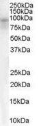 Dipeptidyl Peptidase Like 10 antibody, GTX89564, GeneTex, Western Blot image 