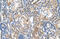 Nuclear Receptor Subfamily 3 Group C Member 2 antibody, 30-075, ProSci, Immunohistochemistry paraffin image 