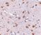 SATB Homeobox 1 antibody, PA5-20534, Invitrogen Antibodies, Immunohistochemistry frozen image 