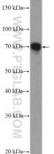 TRNA Methyltransferase 2 Homolog A antibody, 16199-1-AP, Proteintech Group, Western Blot image 