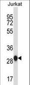 Acidic Nuclear Phosphoprotein 32 Family Member A antibody, LS-C156365, Lifespan Biosciences, Western Blot image 